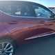 Ford Fiesta Hatchback (17-23) Vignale 1.0T EcoBoost 140PS 5d For Sale - EMG Motor Group Kings Lynn, Kings Lynn
