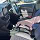 Ford Fiesta Hatchback (17-23) Vignale 1.0T EcoBoost 140PS 5d For Sale - EMG Motor Group Kings Lynn, Kings Lynn